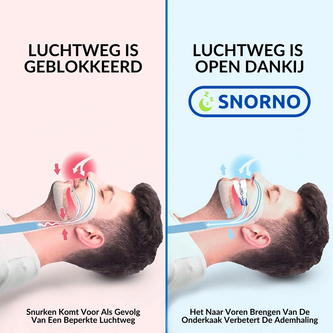 Hoogwaardige snurkbeugel die snurken vermindert en de ademhaling tijdens slaap verbetert. Topkwaliteit.