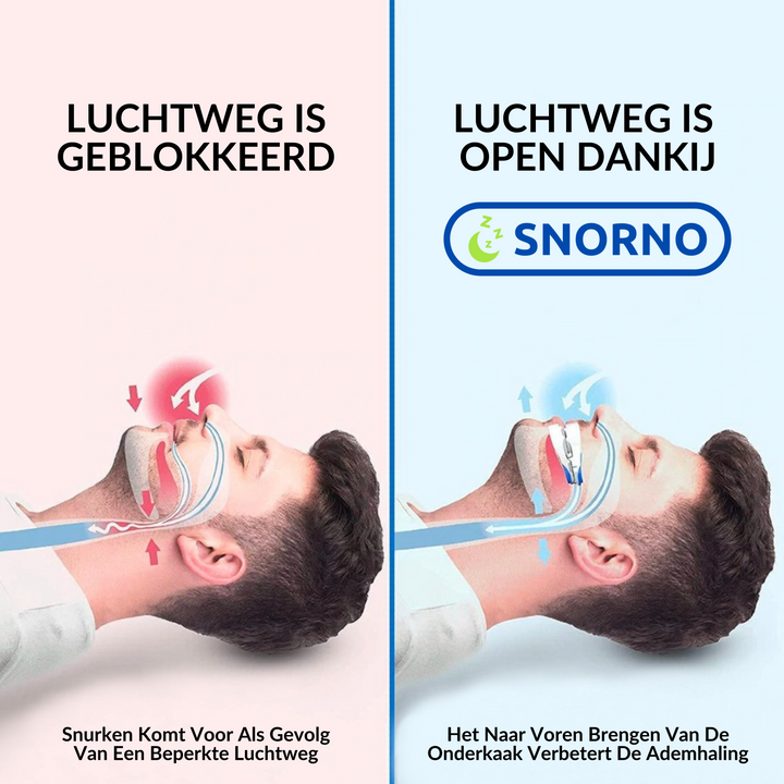 Hoogwaardige snurkbeugel die snurken vermindert en de ademhaling tijdens slaap verbetert. Topkwaliteit.
