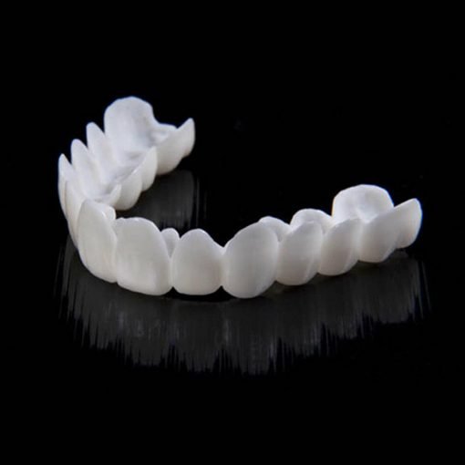 Herbruikbare Snap-On Smile veneers: een cosmetische oplossing voor een witte, egale glimlach.