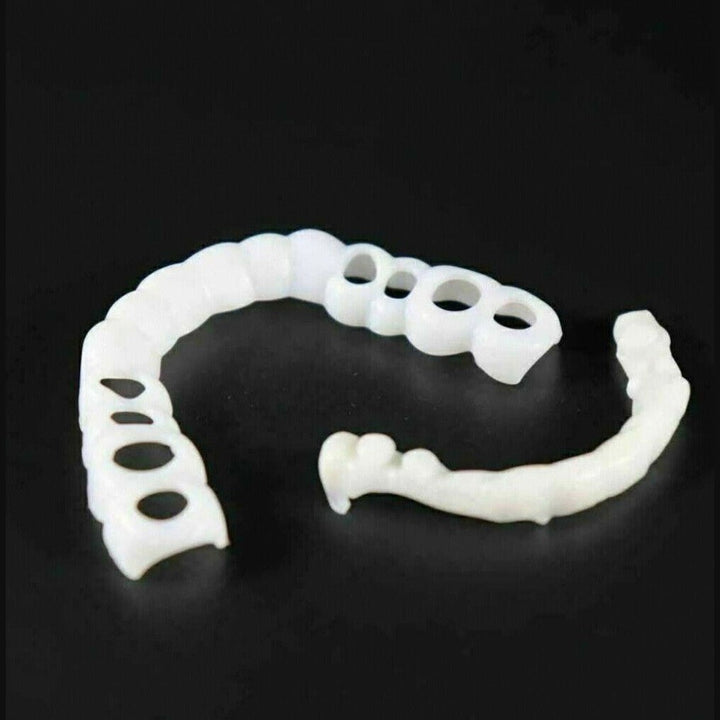 Boost je zelfvertrouwen met Snap-On Smile facings: een esthetische, stralende glimlach direct zichtbaar.