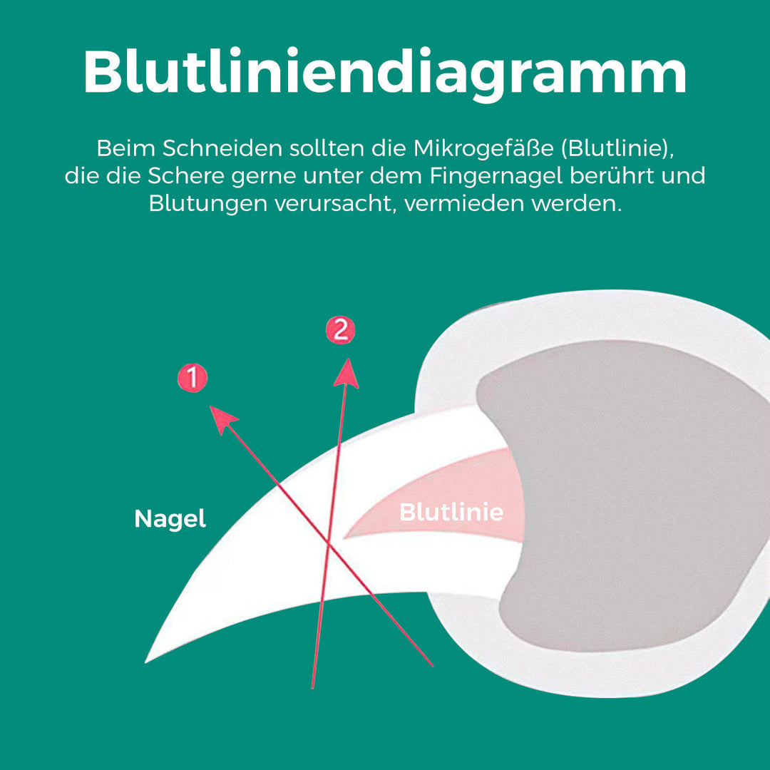 Nagelknipper voor huisdieren met veiligheidssensor, voorkomt overmatig knippen bij honden en katten