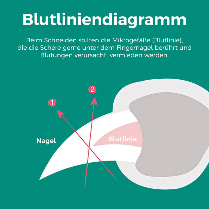 Nagelknipper voor huisdieren met veiligheidssensor, voorkomt overmatig knippen bij honden en katten
