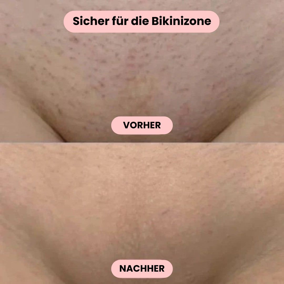 Elektrisch scheerapparaat dames met ergonomisch design, zacht en effectief voor ontharing.