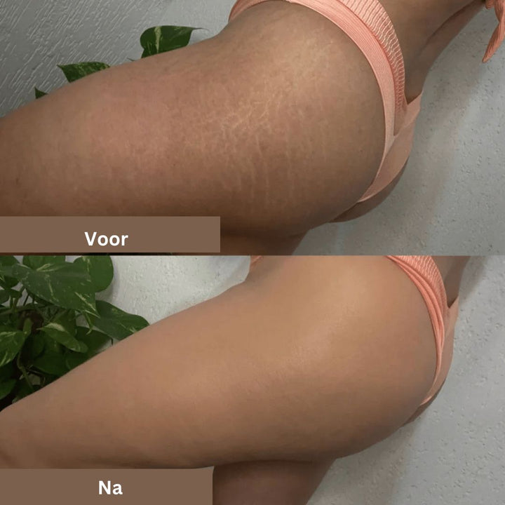 Hoge dekking concealer camoufleert littekens, tatoeages en oneffenheden. Waterdicht en langhoudend voor perfecte huid.
