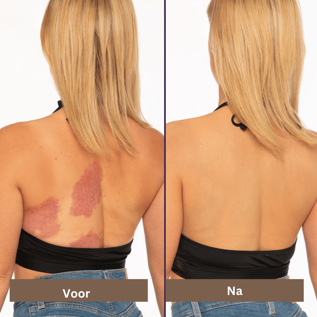 Vlekkeloze gezichts make-up met waterdichte concealer. Hoge dekking verbergt imperfecties voor een egale teint.