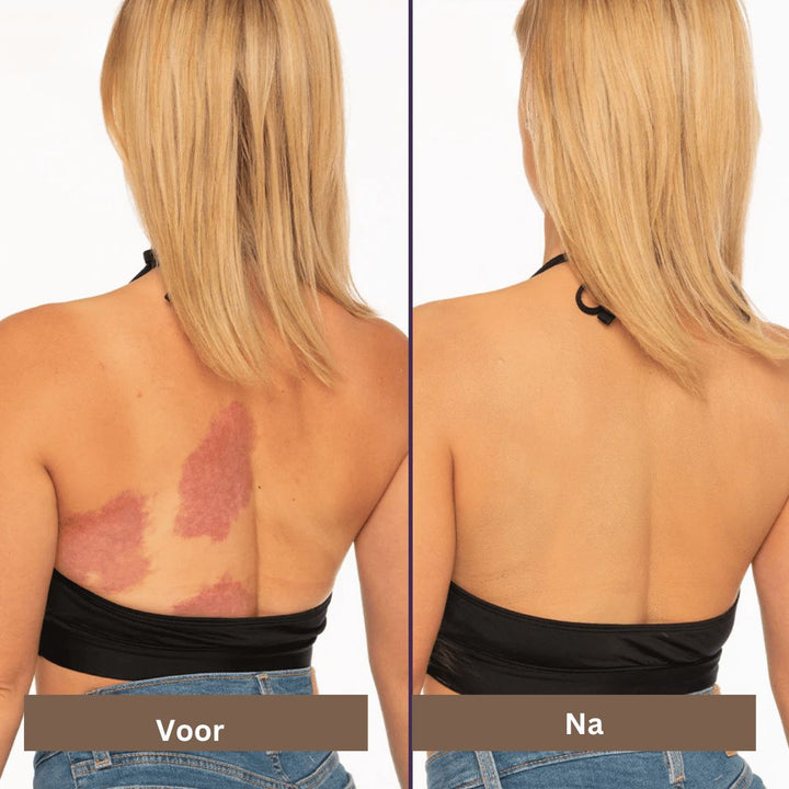Vlekkeloze gezichts make-up met waterdichte concealer. Hoge dekking verbergt imperfecties voor een egale teint.